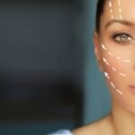 Ultraformer em Barra da Tijuca Tecnologia Avançada para Lifting Sem Cirurgia